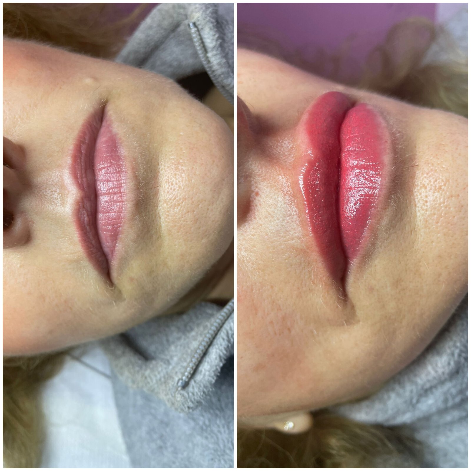 Tratamiento Estética 7
